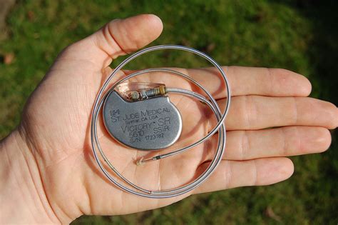 pacemaker battery longevity