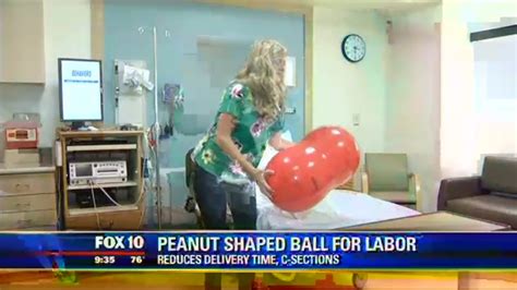 how the peanut ball may shorten labor time and reduce cesarean rates