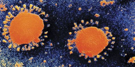 sars   coronavirus sporcle blog