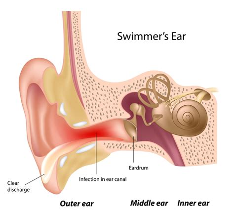 ear canal infection net health book