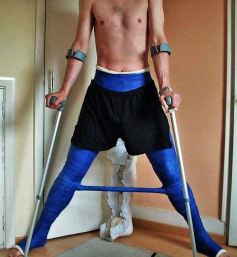Man Blue Double Hip Spica With Spreader Bar Full Body Cast Gips