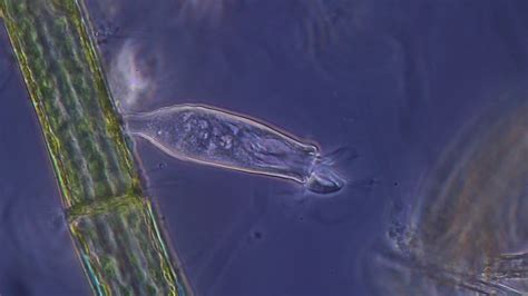 peritrich ciliate scyphidia rugosa youtube