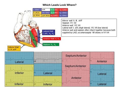 lead ecg reference chart cardiovascular nursing education associates