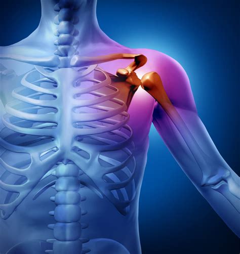 sciatica  pain disc problems neck pain shoulder pain sports