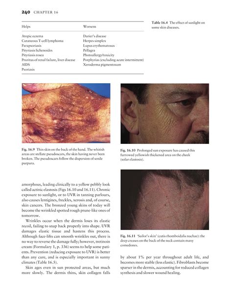 medicine by sfakianakis g alexandros skin disease in