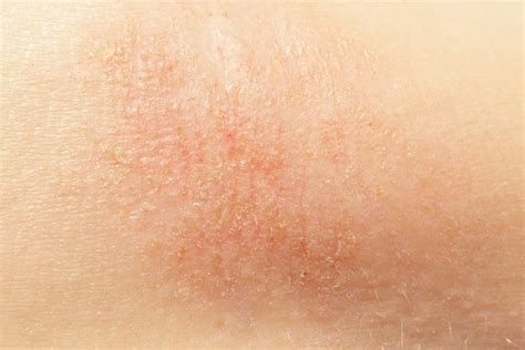 skin diseases  health problems