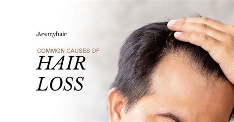 common   hair loss  singapore aremyhair