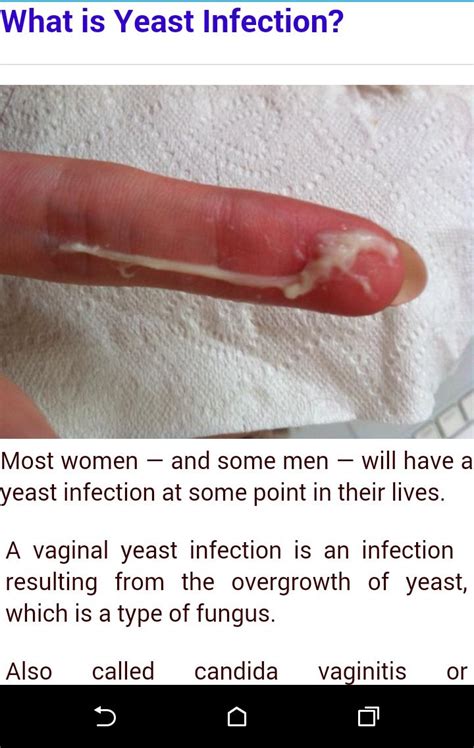 Yeast Infection For Android Apk Download