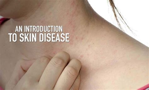 skin disorders types symptoms  prevention treatment