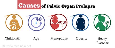 Pelvic Organ Prolapse Types Causes Symptoms Diagnosis Treatment