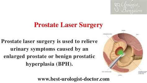 Laser Prostate Surgery In Bangalore Urology Specialist In India