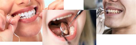 oral hygiene cape dental care