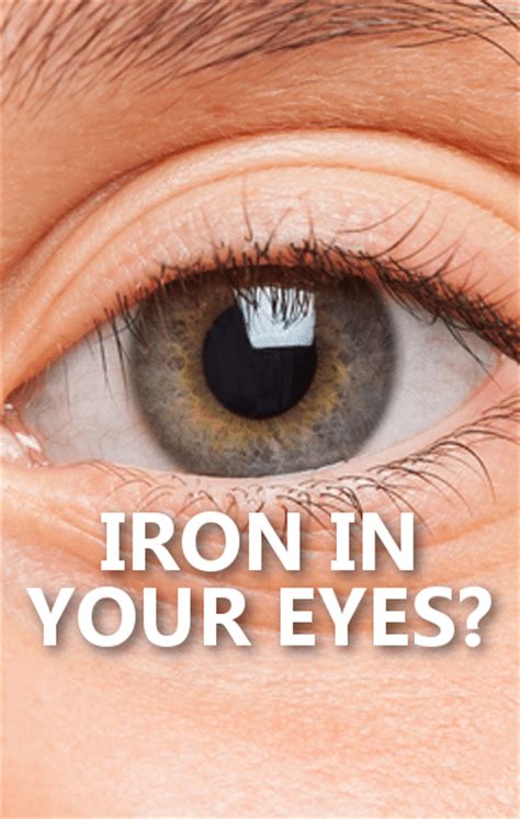 dr oz iron deficiency eye test unexpected spring allergy triggers