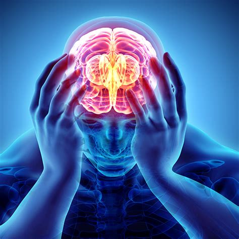 fda greenlights new migraine drug 2018 05 18 ahc media continuing