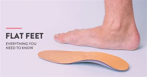 flat feet symptoms  treatment options  exercises