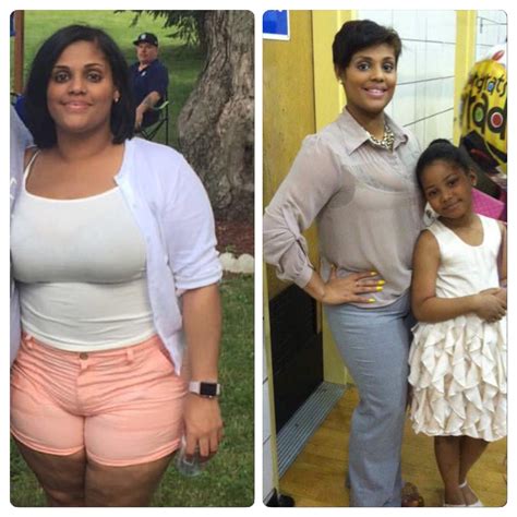 4 years after surgery gained 50 pounds tell your weight loss surgery