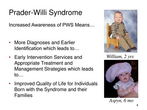 Ppt Prader Willi Syndrome Powerpoint Presentation Free Download Id