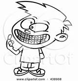 Braces Cartoon Illustration Showing Boy His Toonaday Royalty Rf Clip Outline Drawing Clipart Small Getdrawings sketch template