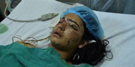amnesty urges india to ban shotgun pellets in kashmir