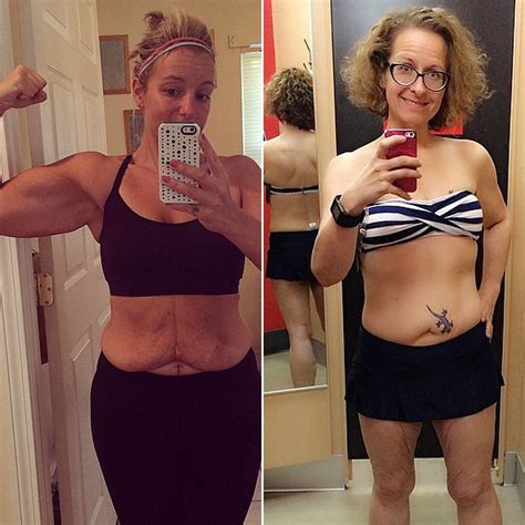 Excess Skin Photos After Weight Loss Popsugar Fitness