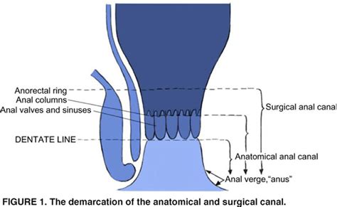 human papilloma virus and squamous cell carcinoma of the anus cancer