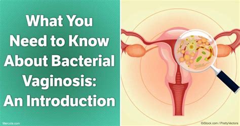 Bacterial Vaginosis And Its Symptoms