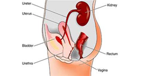 women health mygyno obstetric and gynecology kenya