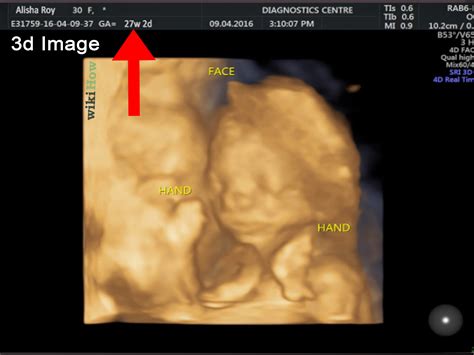 read  ultrasound picture  steps  pictures