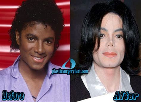michael jackson plastic surgery gone wrong top 10 pictures of