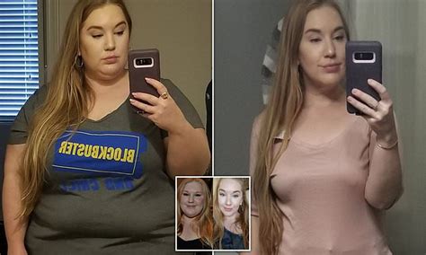 obese woman who ate 4 000 calories a day sheds half her body weight