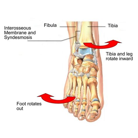 high ankle sprain  physio