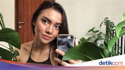 foto pesona angela gilsha yang pd pamer wajah berjerawat dan gigi kuning