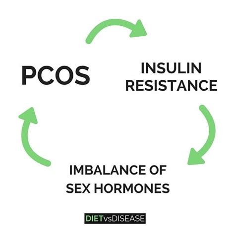 how to lose weight when you have pcos 8 science backed tips