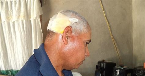 motoconchista recibe martillazo en la cabeza por  pasajero haitiano  era transportado  la