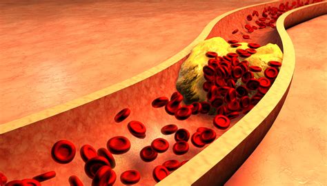 myth  ldl bad cholesterol debunked  health