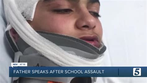 father speaks out after son was assaulted at school