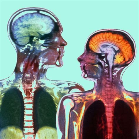 Men’s And Women’s Brains Appear To Age Differently