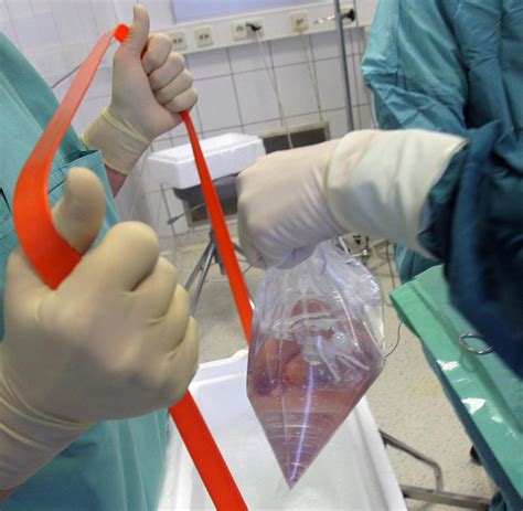 transplantationsgesetz organspende  deutschland grundlegend neu