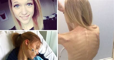 thinspiration selfies almost killed me anorexia survivor s warning
