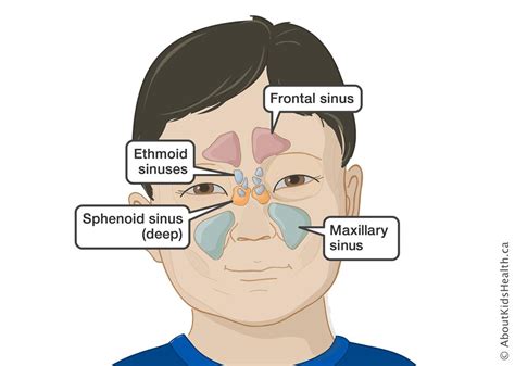 holistic cure for sinus ayurvedic stance for sinusitis nidanam wellness