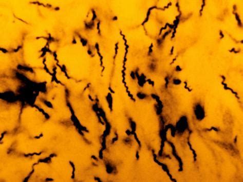 treponema pallidum bacteria  tissue  pathogen