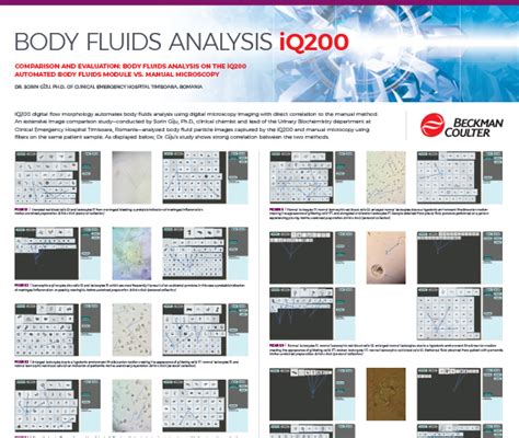 Streamlined Body Fluid Analysis Beckman Coulter