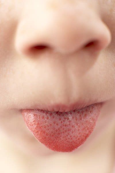 tongue   coated  day    master cleanse livestrongcom