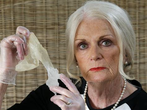 Breast Cancer Linked To Breast Implants Surgeons Warn Herald Sun
