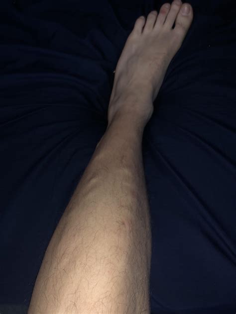 bumps   legs  skin rmedicaladvice