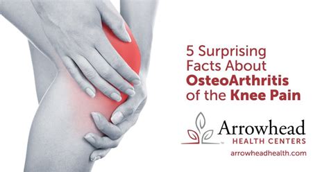 surprising facts  osteoarthritis   knee pain