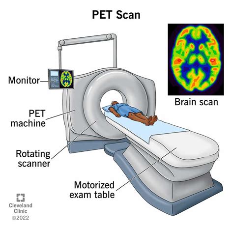 pet scan    types purpose procedure results