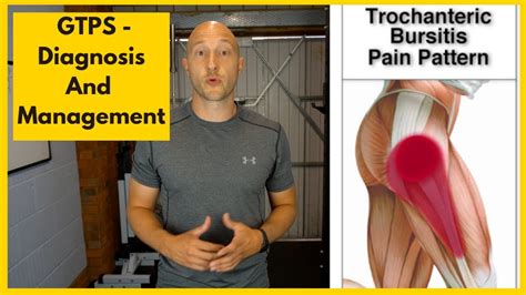 greater trochanteric pain syndrome diagnosis  treatment youtube