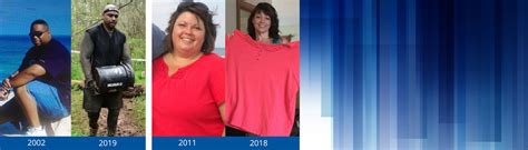 Weight Loss Surgery Before And After Photos Before And