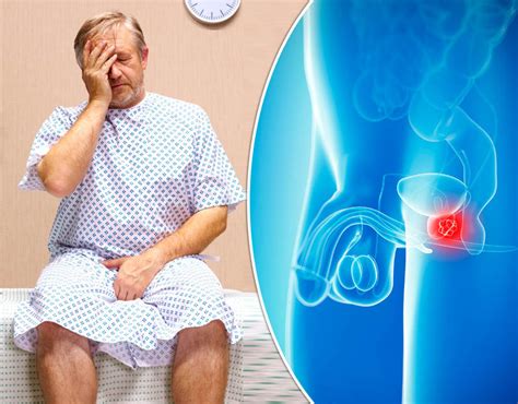 prostate cancer symptoms what is it and how is it linked to sex uk